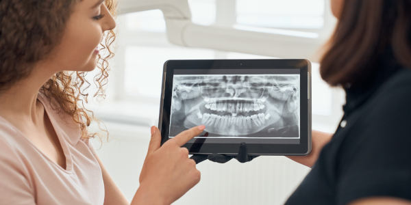 Orthodontie linguale